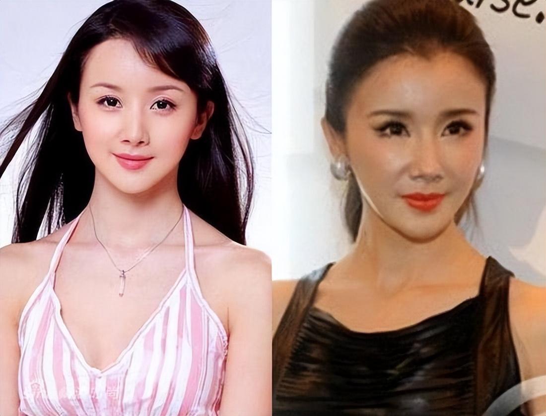 整容女明星前后对比照片 整容女明星成功对比照片
